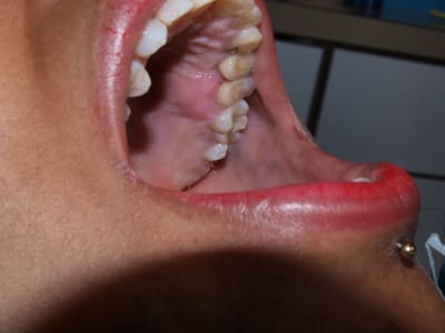 P3241345 sa5kra - Eugenol