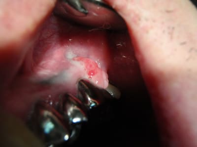 P7070003 gp5ipx - Eugenol