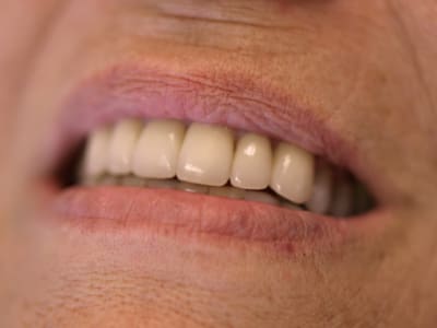 P9165801 lx92x3 - Eugenol