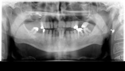 Panoramique x49pip - Eugenol