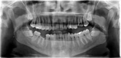 Pano granules xquuhx - Eugenol