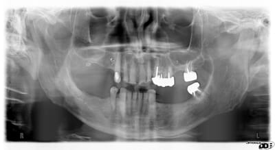 Pano hbn mqgdrm - Eugenol
