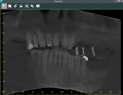 Pano scan fsf8zh - Eugenol