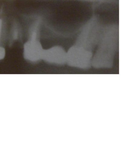 Pano a9ykqs - Eugenol