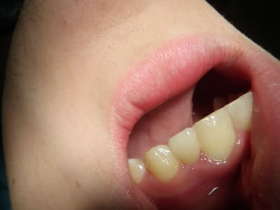 Pc220002 h71mzd - Eugenol