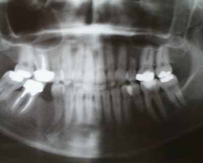 Pic00041 jejw7r - Eugenol