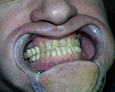 Pic00044 dowqob - Eugenol