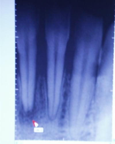 Pic00152 j8rtmr - Eugenol