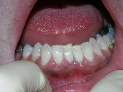 Pict0022 adg7rf - Eugenol