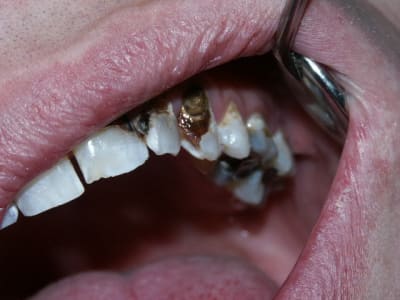 Pict0025 madjjs - Eugenol