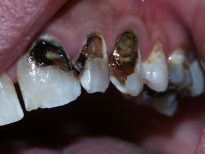 Pict0026 z3u7gu - Eugenol