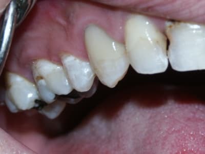 Pict0027 tgd15w - Eugenol