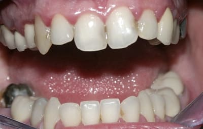 Pict0030 fbs1hm - Eugenol