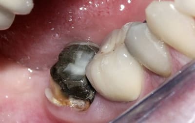 Pict0033 tsx1zc - Eugenol