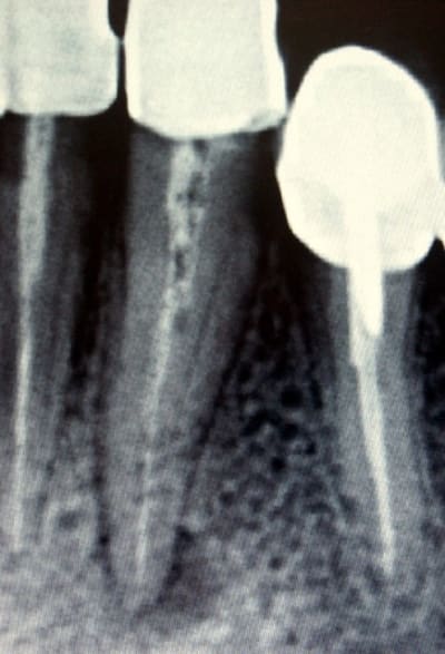 Pict0105 z0kakl - Eugenol