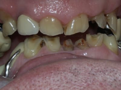 Pict0205 mqrg2i - Eugenol