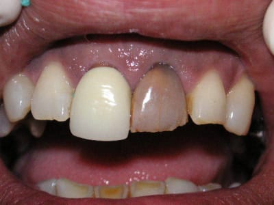 Pict0242 zsmvk3 - Eugenol