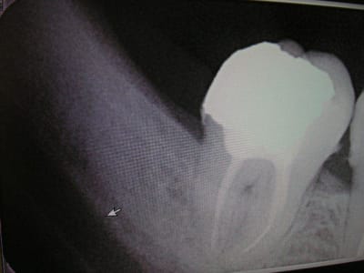 Pict0250 cglsnn - Eugenol