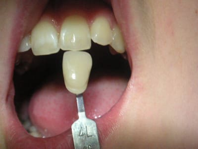 Pict0263 xdbhv4 - Eugenol