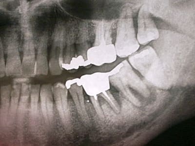 Pict0339 leetnc - Eugenol