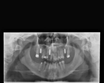 Pic pa dcez2l - Eugenol