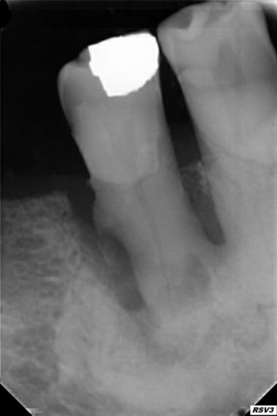 Pmt 45 nckgfc - Eugenol