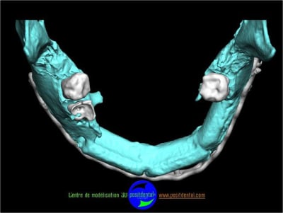 Positdental 2 ee5mcu - Eugenol