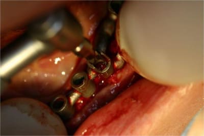 Positdental 2 ohqwnb - Eugenol