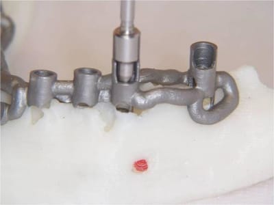 Positdental 8 zfzsgf - Eugenol