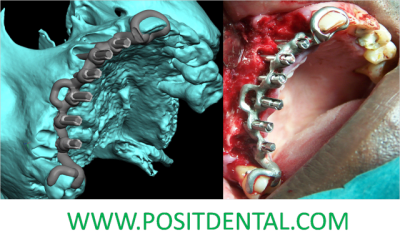 Positdental wm6bg1 - Eugenol