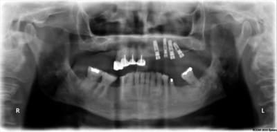 Pr6 thofkn - Eugenol