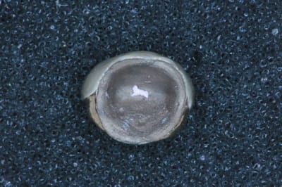 Pr  op couronnes 11 21 002 rebizu - Eugenol