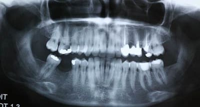 P img 2775 isewpk - Eugenol