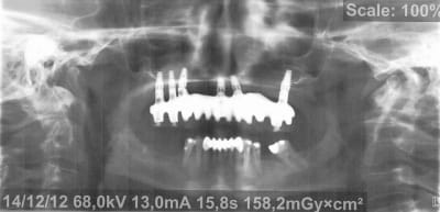 Pano 4 nwdxmg - Eugenol