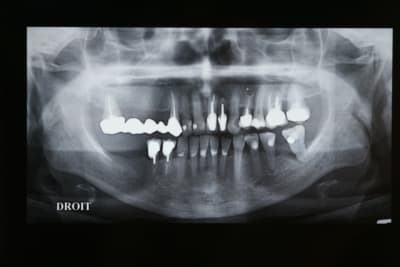 Pano initial djdhkb - Eugenol