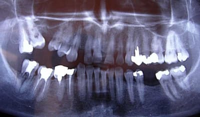 Pano xnp8he - Eugenol