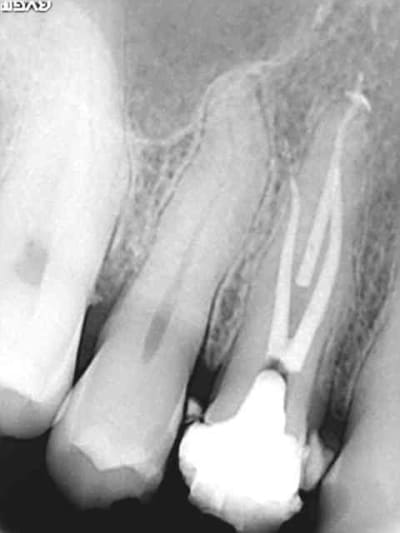 Perrin k5pfqu - Eugenol