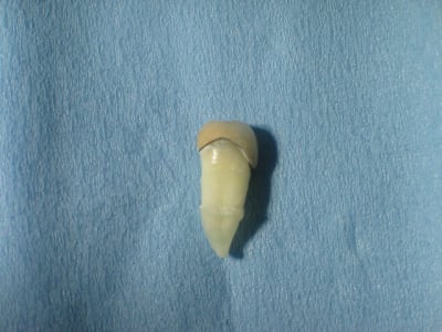 Photo34 002 hnohpr - Eugenol