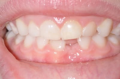 Photo 001 wp0mef - Eugenol