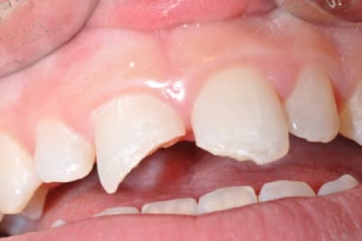 Photo 012 rfllmi - Eugenol