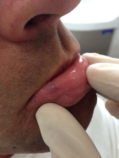 Photo 2013 05 02 12.24 - Eugenol