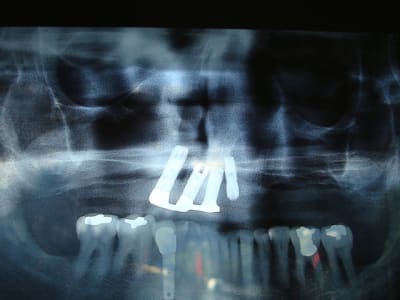Photo 668 j72nw1 - Eugenol