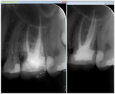 Photo 8 eumyiv - Eugenol