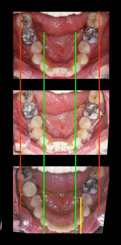 Picture a wcy0sm - Eugenol