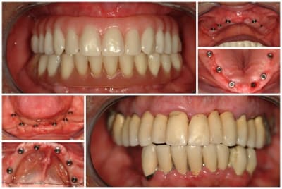 Planche charmois 1 a24nyw - Eugenol