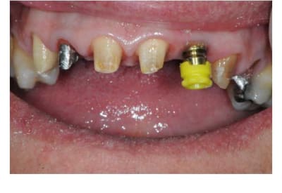Planche contact 016 copie lfl28d - Eugenol