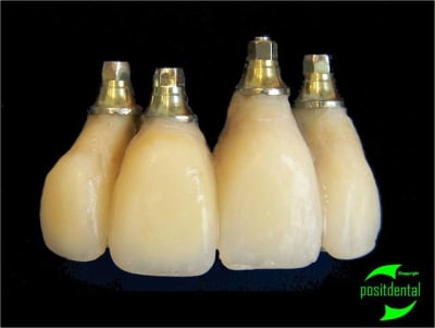 Porte implant triple focntion euroteknika 1 sopizu - Eugenol