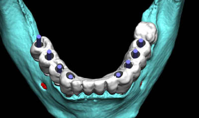 Positdental 1 uhqkzv - Eugenol
