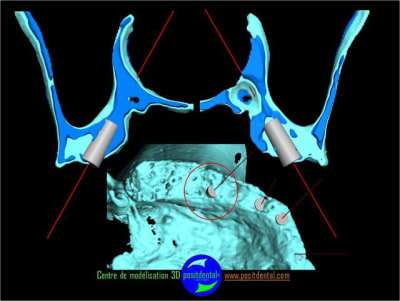 Positguide 6 qd60cc - Eugenol