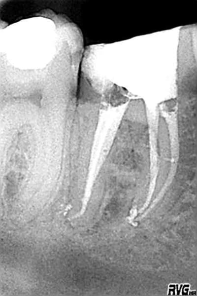 Post op défilé hxcj2c - Eugenol